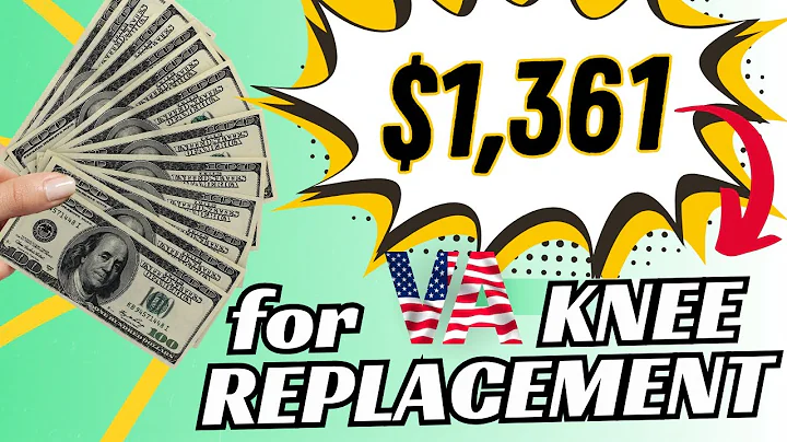 How To Obtain 60% For VA Claim - Knee Replacement Only!