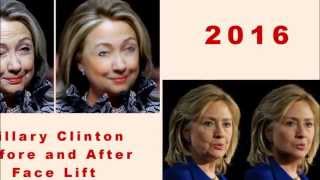 BREAKING NEWS Hillary Clinton Face Before and After Face Lift #205