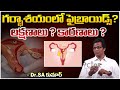 గర్భాశయంలో ఫైబ్రాయిడ్స్ ? లక్షణాలు ?  కారణాలు ?  | Dr Sa Kumar  | My Doctor