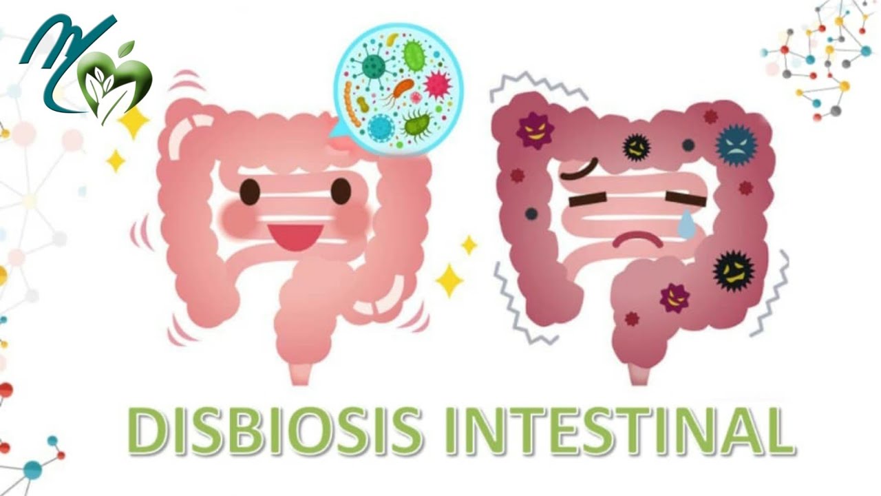 Qué Es La Disbiosis Intestinal – JYZXLK