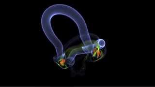 Collision of two vortex rings at Re = 10000