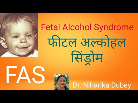 Fetal Alcohol Syndrome | FAS | फीटल अल्कोहॉल सिंड्रोम |भूर्ण मद्य सिंड्रोम