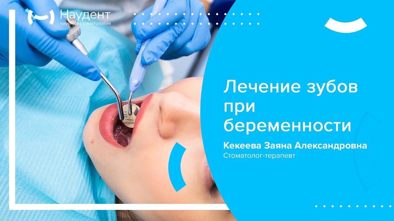 🤰 Лечение зубов при беременности