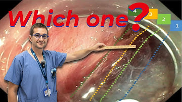 4 secrets to find the PERFECT Dissection Plane