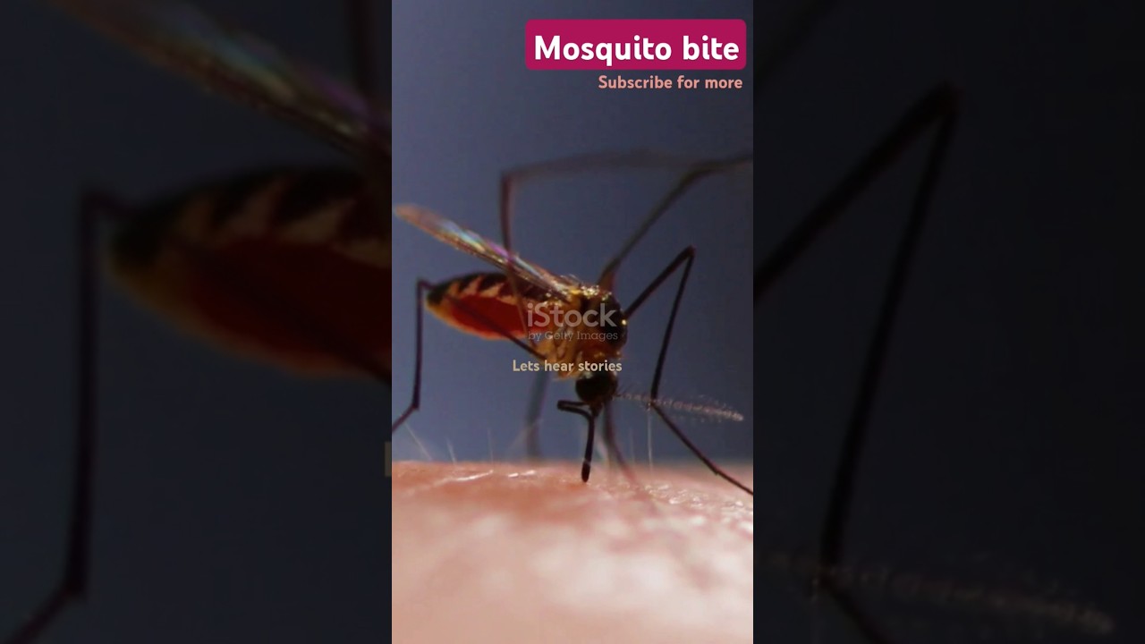 Mosquito bite explanation 
