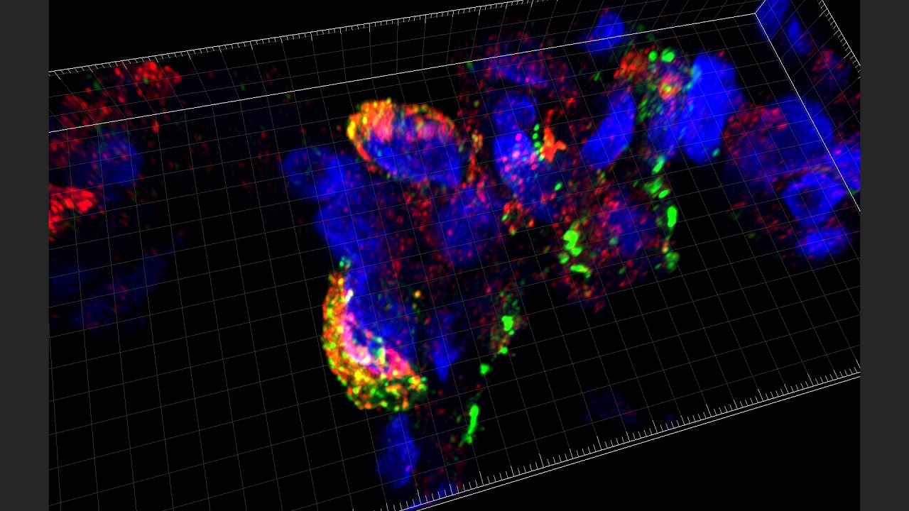 20-Month Human Lung D043 SFTPB and ABCA3 Enhanced Resolution_002