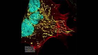 A Cancer Cell With Three Nuclei | 2022 #NikonSmallWorld #Microscopy