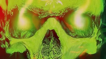 Flip the Switch (Official Video)