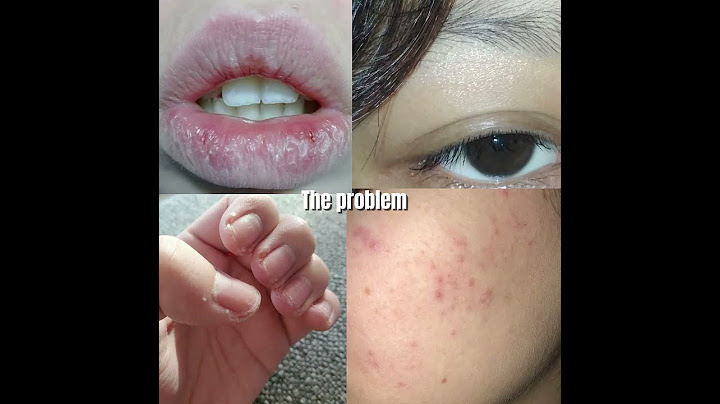 Use only Vaseline if your struggling.