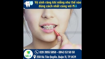 Vệ sinh răng khi niềng răng như thế nào đúng cách?