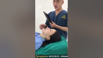 COMBO NÂNG MŨI CẤU TRÚC + ĐỘN CẰM V LINE NHƯ THẾ NÀO  REVIEW ĐỘN CẰM Ở ĐÂU ĐẸP