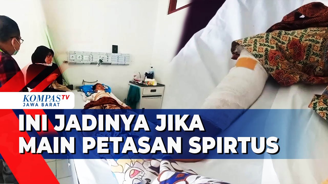 Duh, Jangan Main Petasan Spirtus, Nanti Begini Jadinya