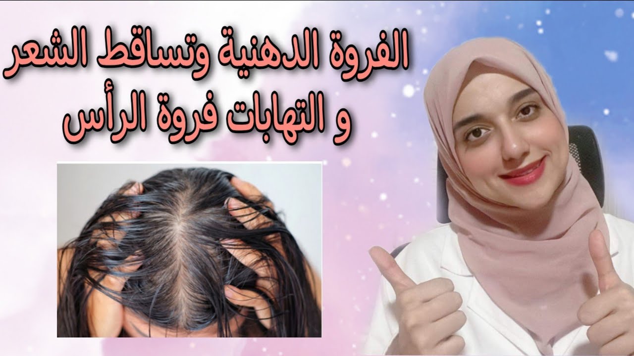 افضل انواع شامبو للفروة الدهنية والشعر الدهنى /الفروة الدهنية والشعر الجاف /منع القشرة وتساقط الشعر