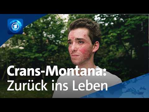 &Uuml;berlebende von Crans-Montana: Der schwere Weg zur&uuml;ck ins Leben

41 Menschen starben bei der Brandkatastrophe von Crans-Montana an Neujahr. Mehr als hundert weitere wurden meist schwer verletzt.

#&Uuml;berlebende #von #Crans #Montana #Der