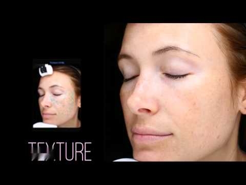 კანის დეტალური 3D დიაგნოსტირება კლინიკა მედიში