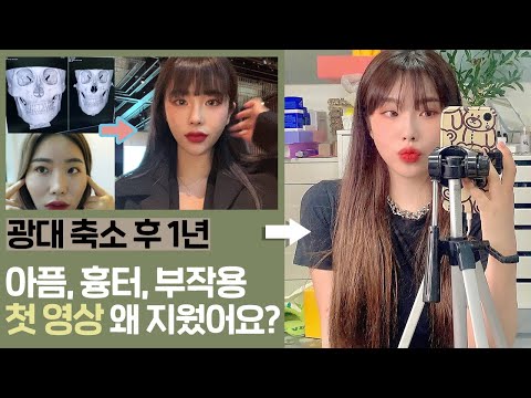 Q&amp;amp;A <strong>광대</strong> <strong>수술</strong> 후 1년이 지났어요! 아픔, 흉터, <strong>부작용</strong> 등 모든내용을 넣었습니다 ! 그리고 이제 더이상,,, | 달리아 daHlia ❊