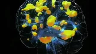 Famous Activation of visual cortex Profile