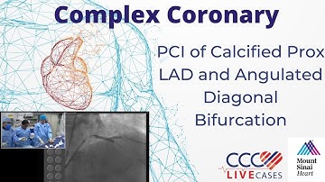 PCI of Calcified Prox LAD and Angulated Diagonal Bifurcation - CCC Live Jan 2017