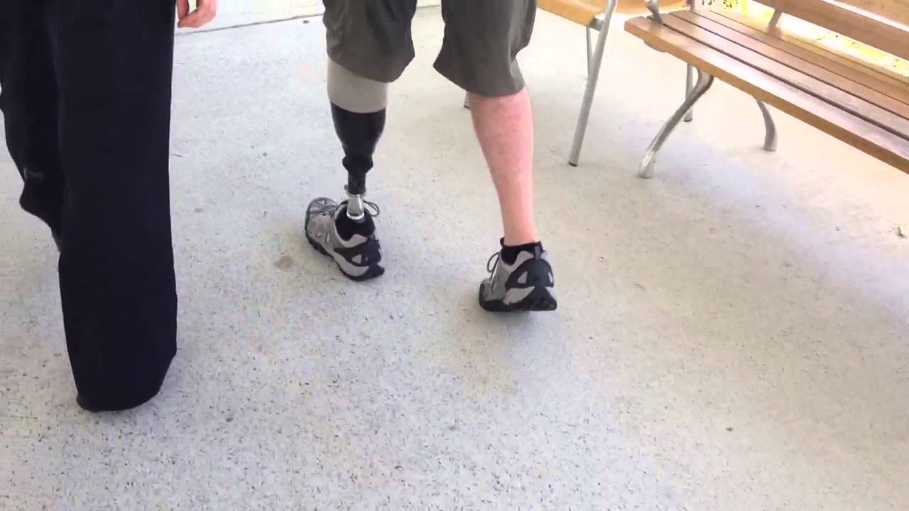 Walking Amputee YouTube
