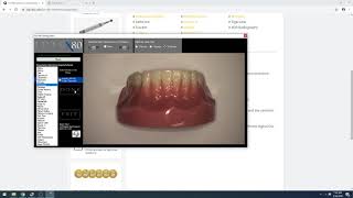 Iris X80 Integration for Curve Dental screenshot 1