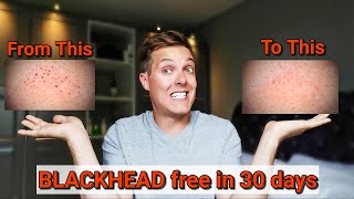 Eradicate Blackheads 30 Day Skincare Routine For Smaller Pores And Clear Skin Youtube