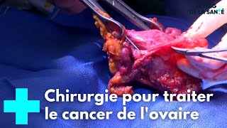 Cancer de l'ovaire : une chirurgie incontournable