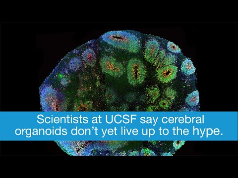 Brain Organoids Flunk Comparison to Developing Brains