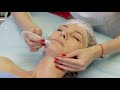 👌💥 Обучающие видео - Аппарат Вакуумного массажа V-02