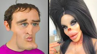 When Plastic Surgery Goes Horribly Wrong