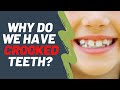 Why do we have crooked teeth | Dentist Explained (2021)