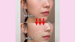 3 Minutes Get an Apple Cheek Lift, Sagging Cheek and Smile Line. #faceyoga #smilelines #exercise #yt