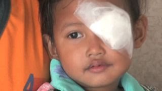 'Flying hospital' on mission to save people's eyesight