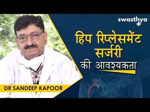 हिप रिप्लेसमेंट सर्जरी की आवश्यकता | Dr Sandeep Kapoor on Hip Replacement Surgery in Hindi