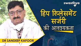 Need For Hip Replacement Surgery  Dr Sandeep Kapoor On Hip Replacement Surgery In Hindi