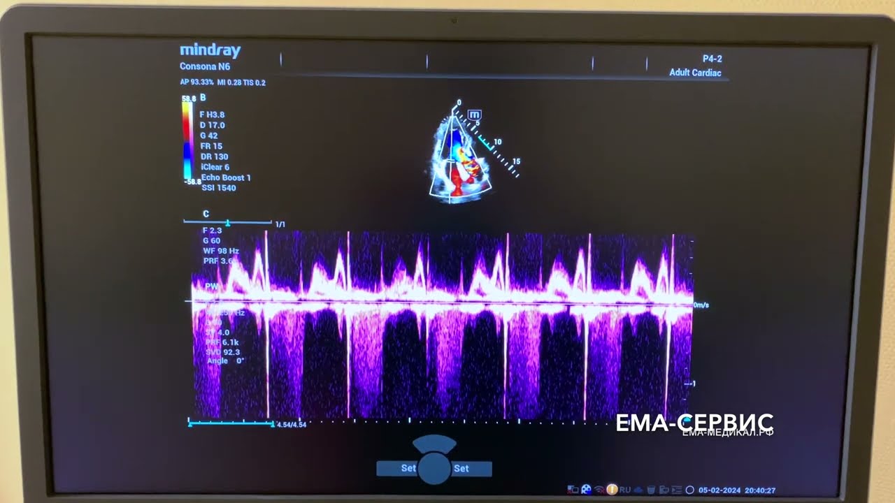 УЗИ аппарат Mindray Consona N6 ZST+ (средний класс)