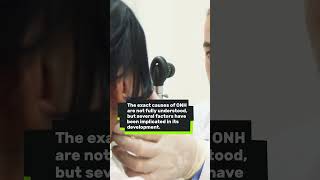 What Causes Optic Nerve Hypoplasia? Can Stem Cells Help? | Vision Improvement
