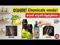 "താരൻ വേരോടെ പിഴുതെറിയാം!  4 Ayurveda Shampoo for Dandruff4 മികച്ച ആയുർവേദ ഷാംപൂകൾ." 