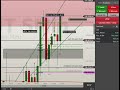 🚨 OPERAÇÃO NO MINI ÍNDICE (WIN) | LEITURA PROFISSIONAL + ZONAS DE VALOR + PRICE ACTION 🚨