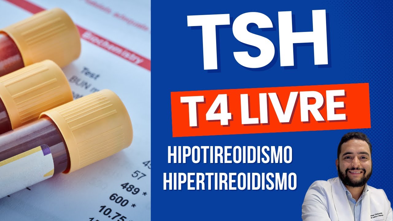 TSH e T4 livre - Hipotireoidismo e Hipertireoidismo - YouTube TSH e T4 livre - Hipotireoidismo e Hipertireoidismo - YouTube