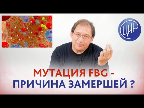 Мутация FBG и замершая беременность. Может ли фибриноген 4,3 быть причиной замершей беременности?