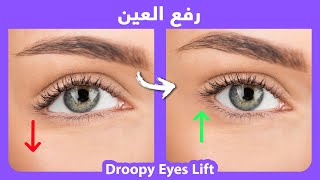 How to naturally lift droopy eyes