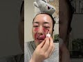 ティントでクマやたるみの影が消えるって本当？【検証】