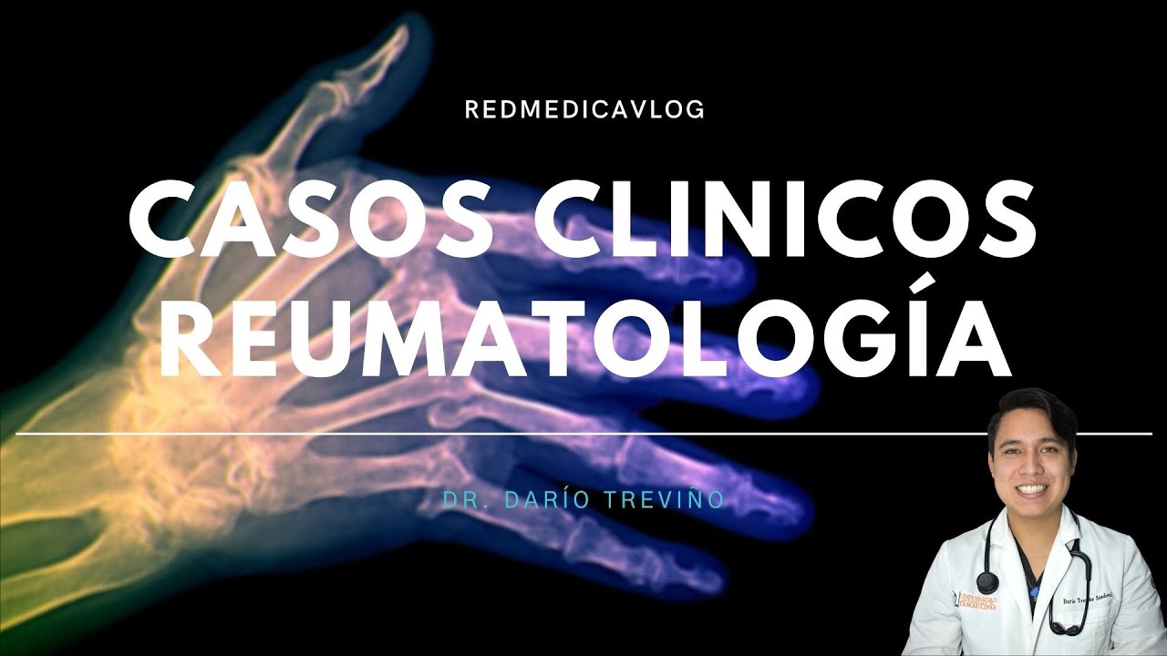 Casos clinicos de Reumatología | ENARM2020