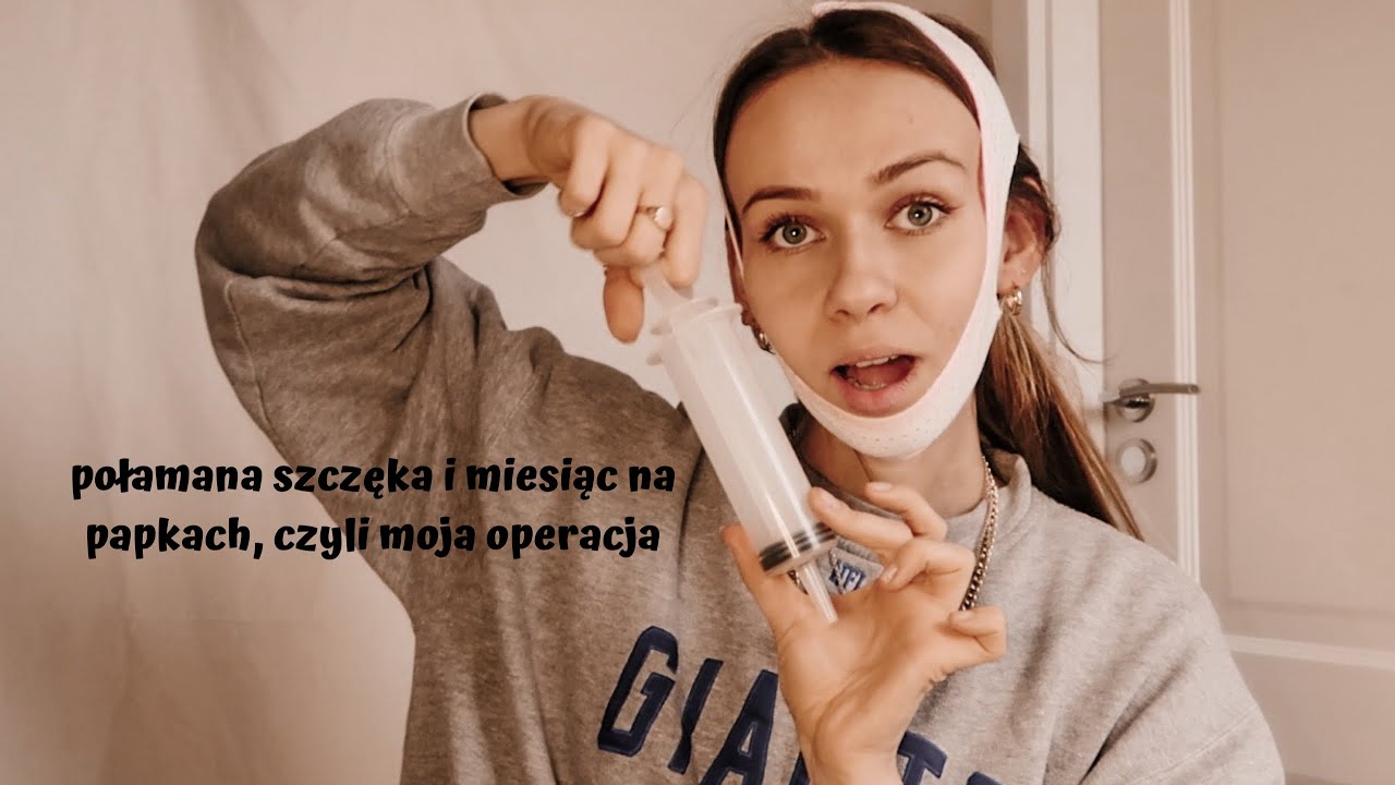 moja progenia (tw: ujęcia po operacji)