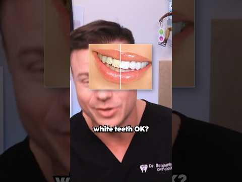 How You Are Whitening Your Teeth The WRONG Way!