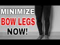 5 YOGA EXERCISES FOR BOW LEGS - Minimize Bow Legs NOW (lock-down TIP!)
