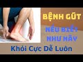Bệnh Gút Chữa Mãi Không Khỏi Thì Chỉ Việc Làm Như Thế Này 3 Ngày Đi Được
