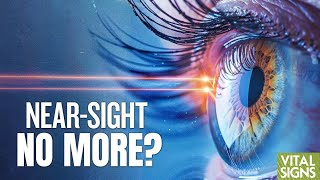 Top Myopia Treatments Natural Remedy Medicine Lifestyle Dr Rani