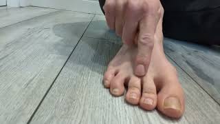 Hammertoe mobility and strengthening