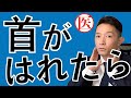 首がはれたら【頸部リンパ節腫脹/癌を見逃さないために】